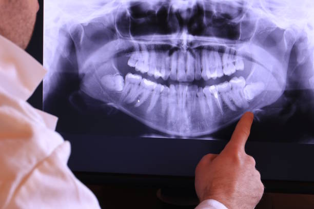 Best Emergency Dental Care for Trauma or Injury in Fruitport, MI