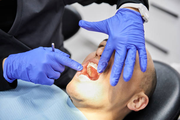 Best Emergency Tooth Extraction in Fruitport, MI
